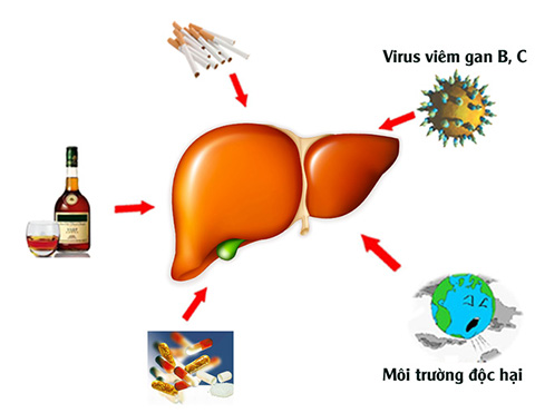 Nguyên nhân bệnh gan